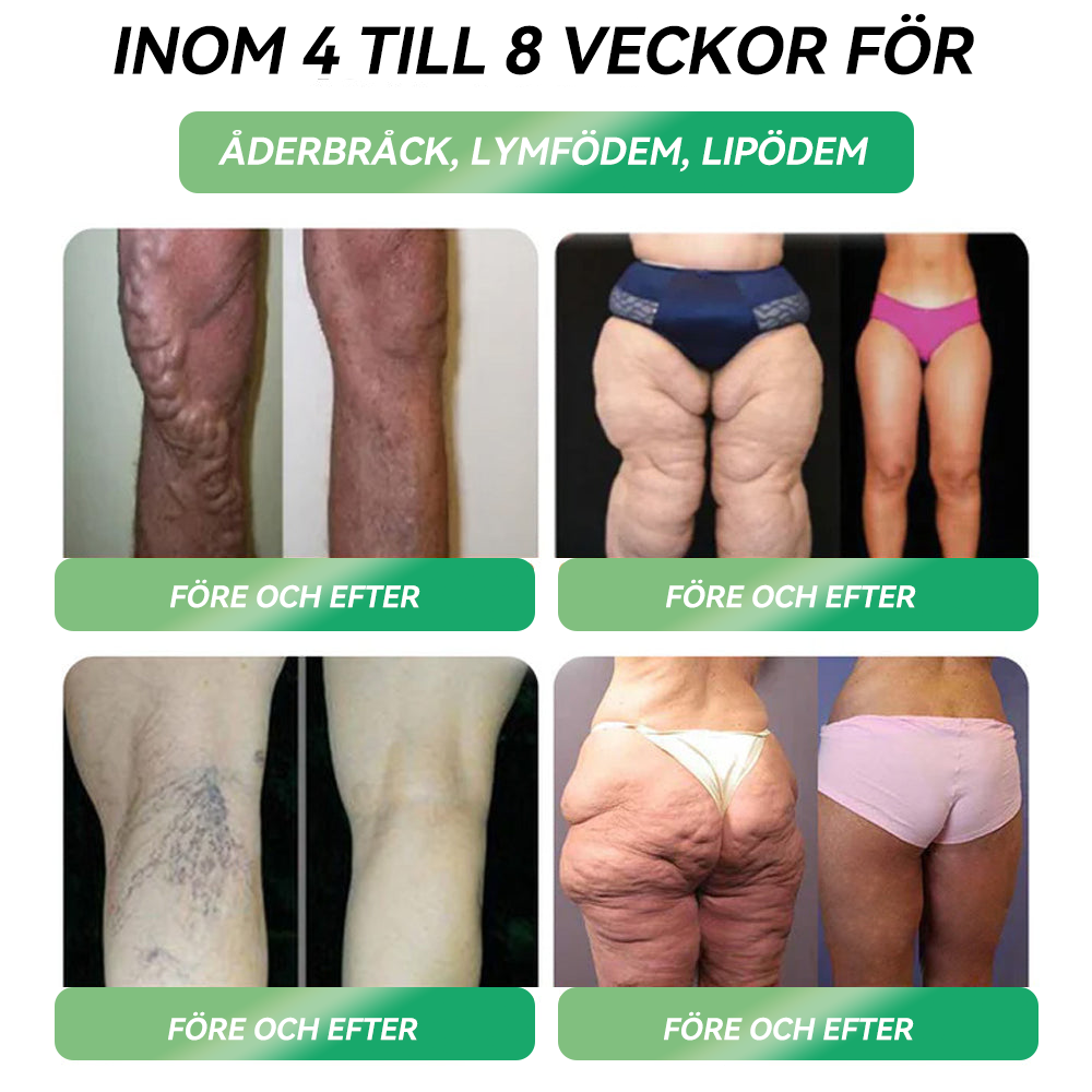 Officiell butik | 𝐇𝐇𝐕𝐁®🎁🎁𝐆𝐋𝐏-𝟏 SIX-IN-ONE Hälsolösning Oral Vätska (En dos varje dag – synliga resultat på bara 7 dagar) ✅ För fetma, hjärt-kärlhälsa, diabetes, sömnapné, ledproblem och mer 🎁