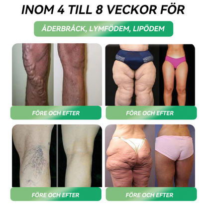Officiell butik | 𝐇𝐇𝐕𝐁®🎁🎁𝐆𝐋𝐏-𝟏 SIX-IN-ONE Hälsolösning Oral Vätska (En dos varje dag – synliga resultat på bara 7 dagar) ✅ För fetma, hjärt-kärlhälsa, diabetes, sömnapné, ledproblem och mer 🎁